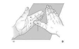 Rétropulsion du pouce selon Kapandji 0–4
